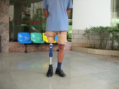 假肢是怎么裝在腿上的正確穿戴大腿假肢的方法(圖1) 假肢是怎么裝在腿上的正確穿戴大腿假肢的方法(圖1)