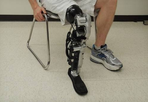 小腿假肢價格患者穿戴假肢過程中遇到問題如何解決(圖1) 小腿假肢價格患者穿戴假肢過程中遇到問題如何解決(圖1)